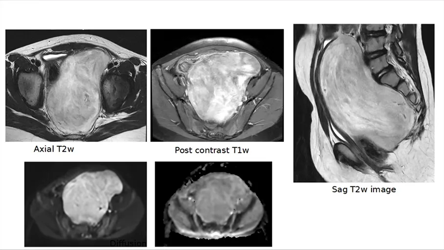 Case Image